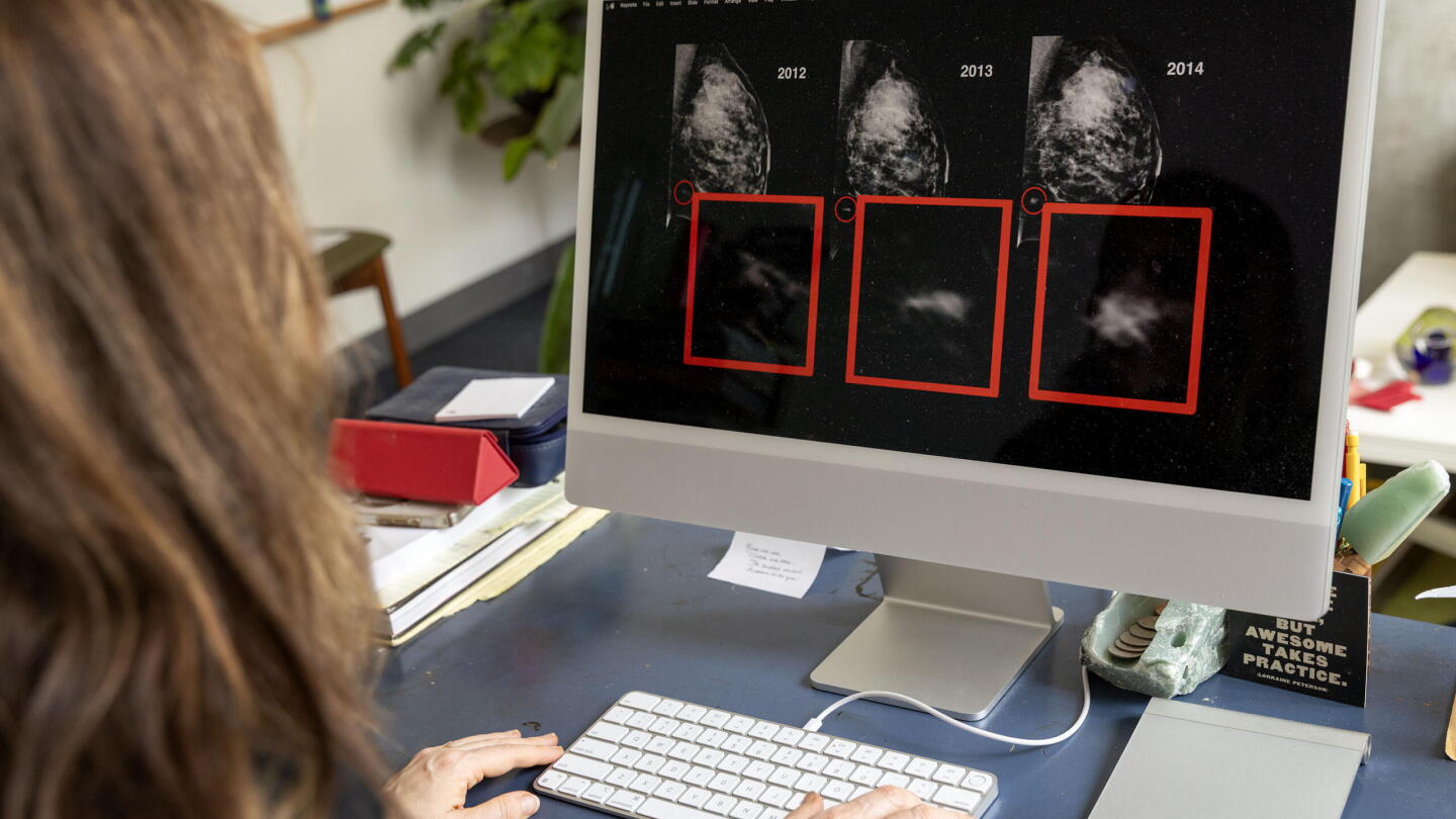 AI can detect breast cancer risk before humans. Why it may take hospitals a while to adopt the tech